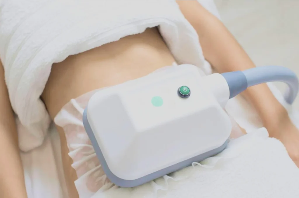 How Fat Freezing and HIFU Work Together? 3 advantages to combining Fat Freezing and HIFU West Bridgford