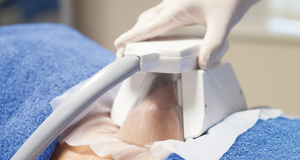How Fat Freezing and HIFU Work Together? 2 Multiple Areas in One Session HIFU and Fat Freezing West Bridgford