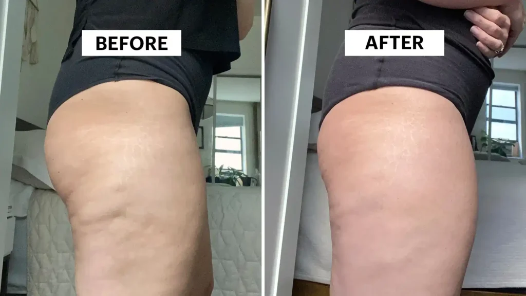 Do Toning Exercise West Bridgford Really Tackle Cellulite?