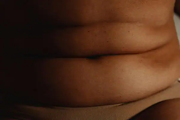 The Hidden Connection: How Stress Shapes Your Fitness and Body Composition 3 image of what stress can do on the stomach area and how Lipo 360 West Bridgford can help to change your body shape.