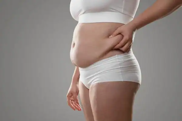 Image of stress belly West Bridgford How Lipo 360 can help manage your symptoms
