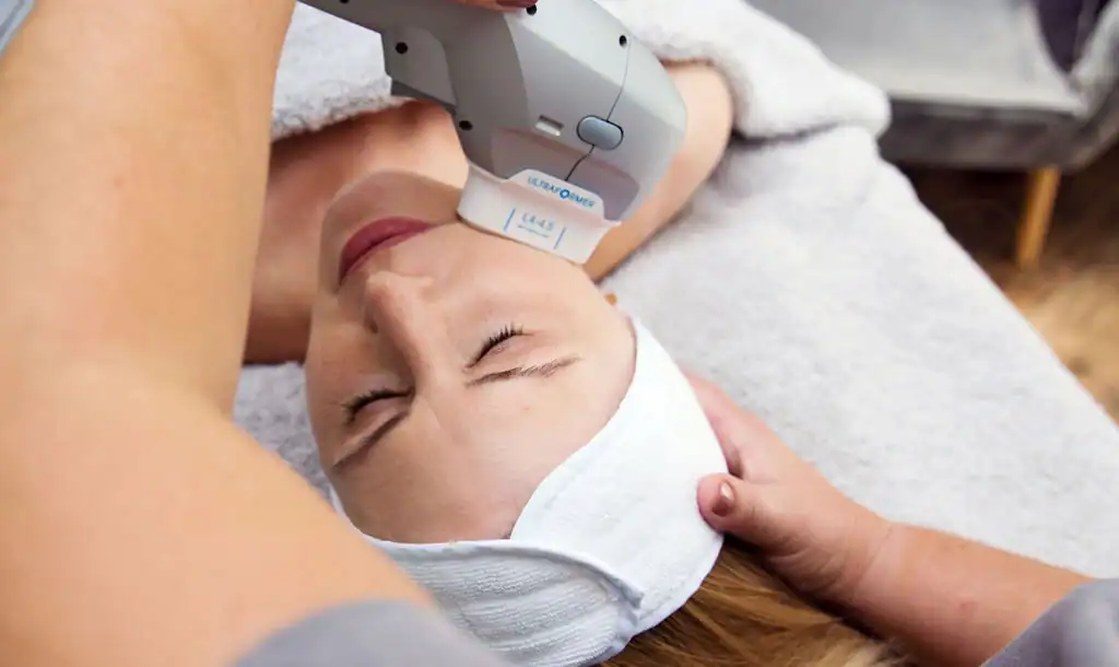 Discover the Perfect Duo: RF Microneedling and HIFU 1 Image of Morpheus8 And HIFU West Bridgford combined treatment